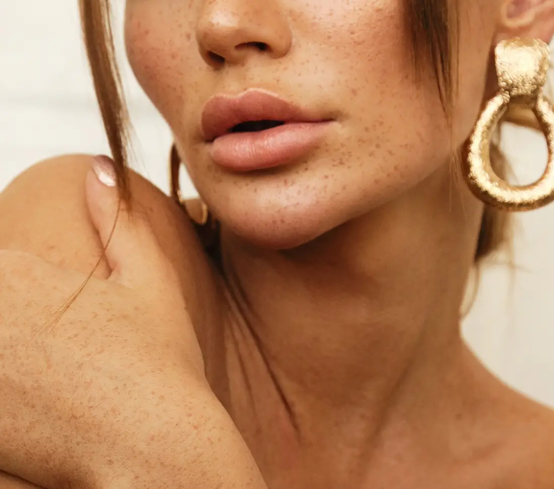 Pretty lips | Lip fillers | Aesthetica Med Spa In Austin, TX